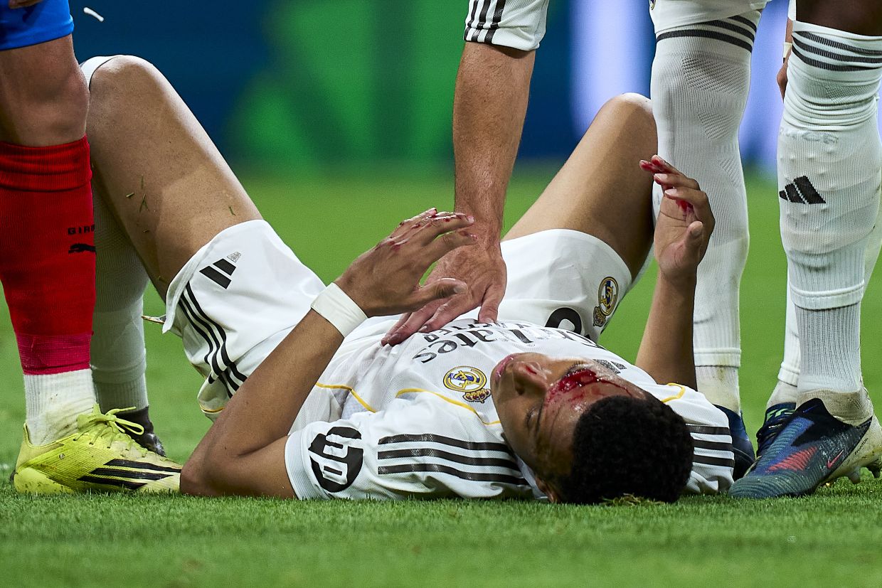 В матче с «Жироной» Арбелоа поставил антирекорд, а Мбаппе остался с разбитым лицом